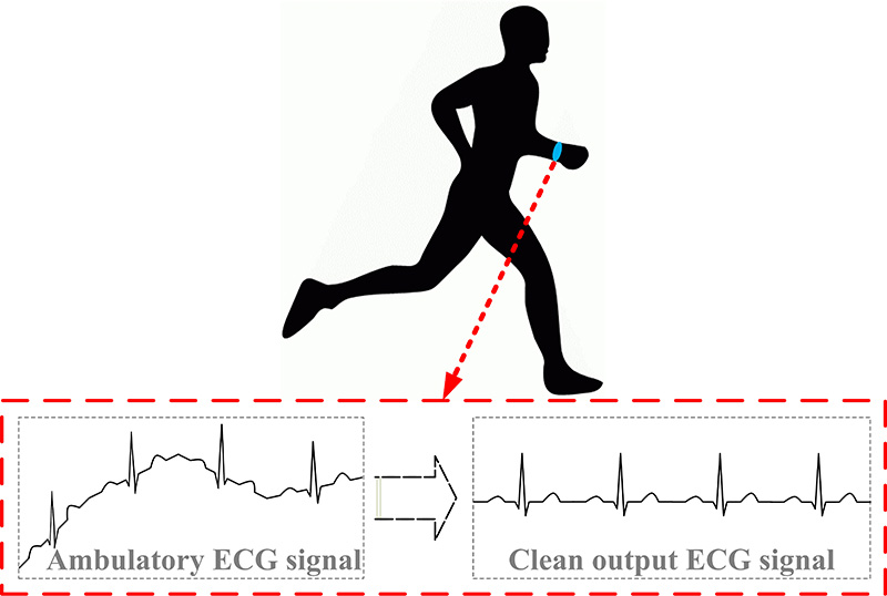 ECG monitoring ECG waveform designed at The University of Akron